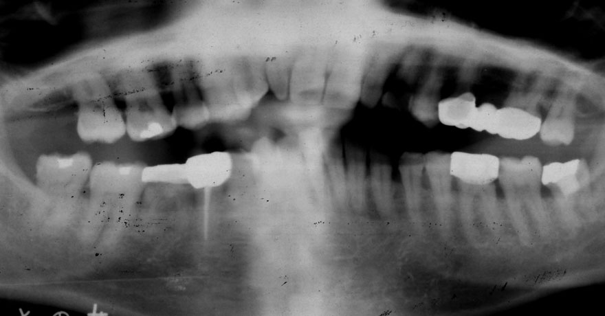 �͓c���Ȉ�@