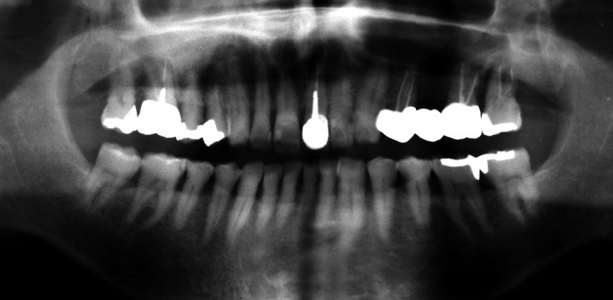 �͓c���Ȉ�@