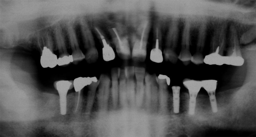 �͓c���Ȉ�@