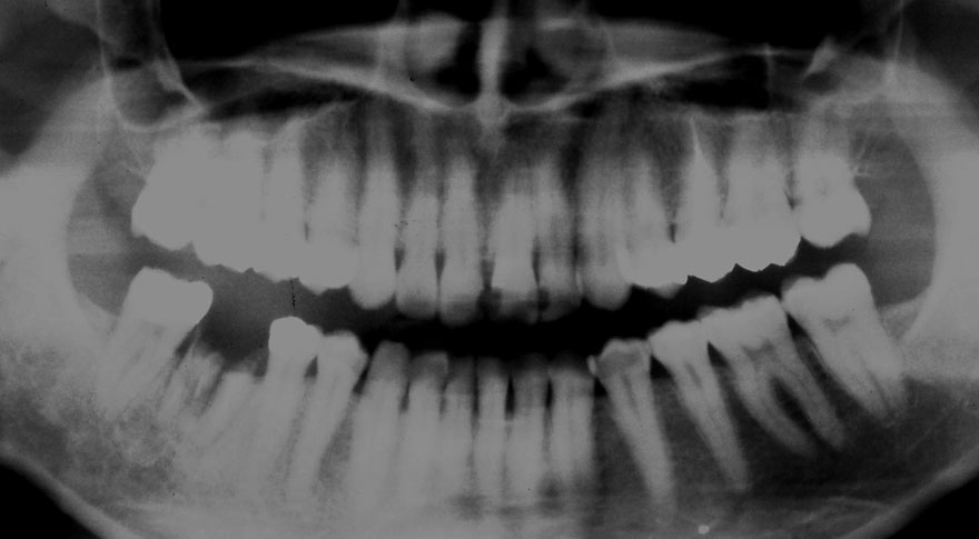 �͓c���Ȉ�@