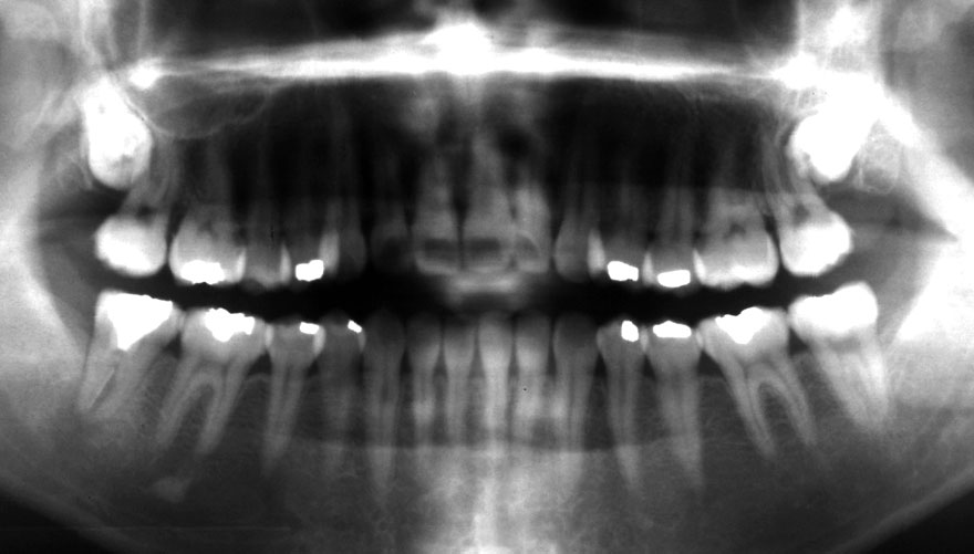 �͓c���Ȉ�@