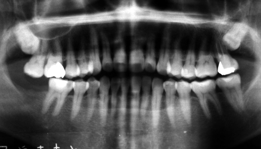 �͓c���Ȉ�@