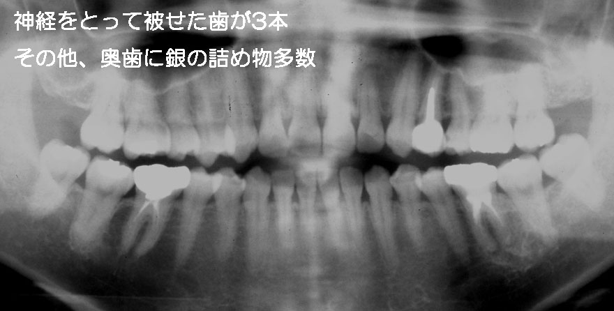 ͓cȈ@