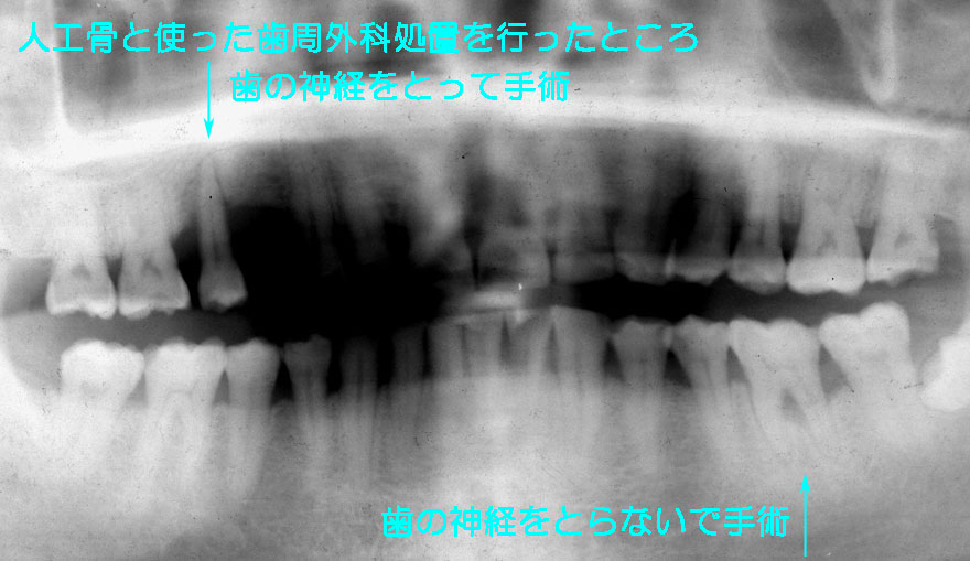 ͓cȈ@