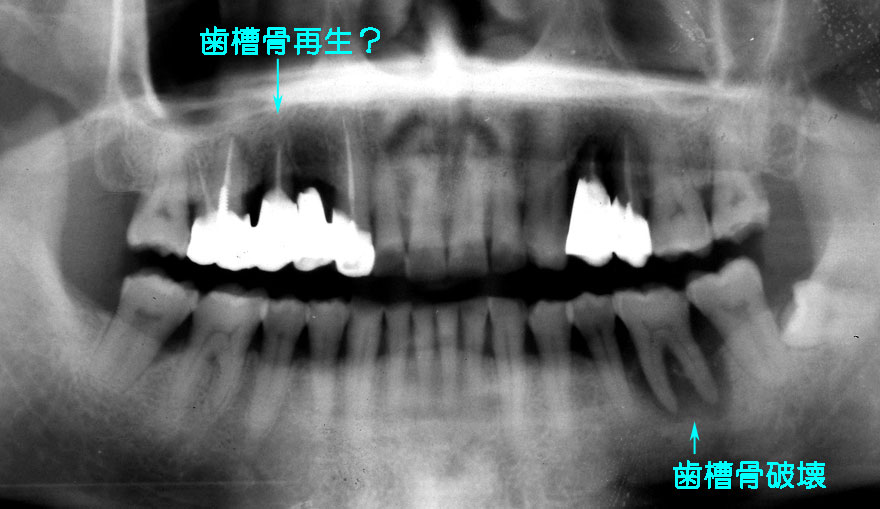 ͓cȈ@