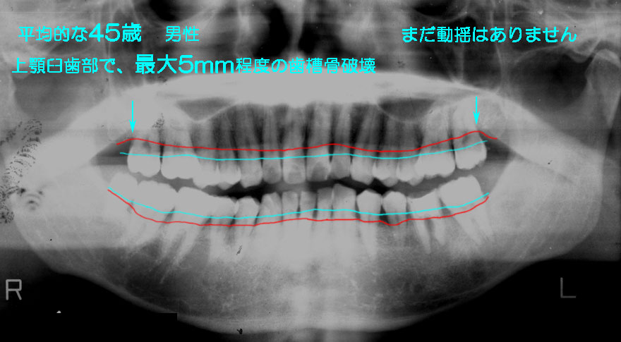 ͓cȈ@