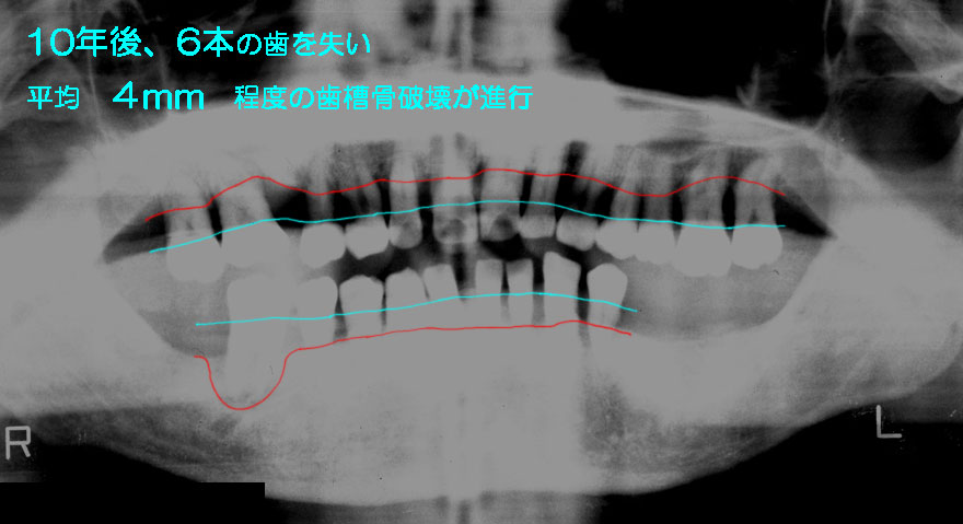 ͓cȈ@