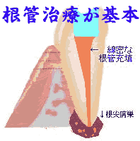 [؏p