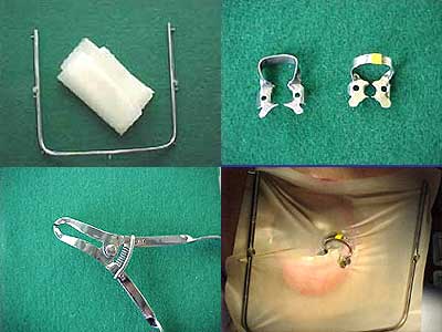 ���o�[�_��