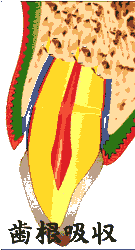 ĐA