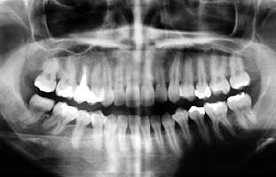 �_�o�𔲂��Ȃ��ƃ_���H