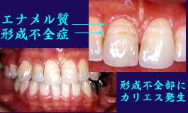 あなたは一生「自分の歯」で食べられますか？ かしこい歯医者の